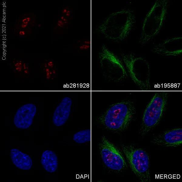Alexa Fluor® 647 conjugated Anti-Ki67 antibody [SP6