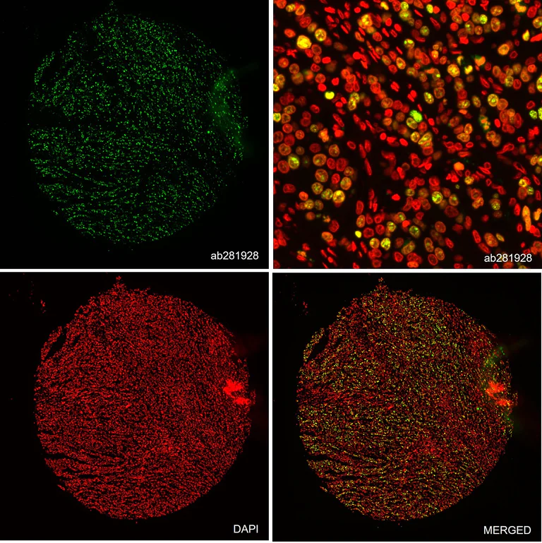 Alexa Fluor® 647 conjugated Anti-Ki67 antibody [SP6] (ab281928