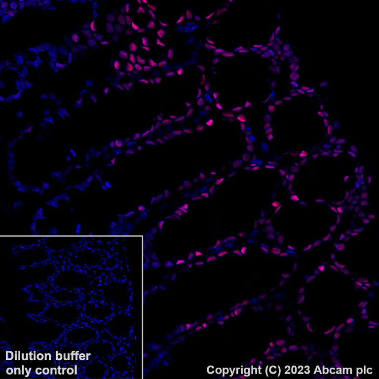 Immunohistochemistry (Formalin/PFA-fixed paraffin-embedded sections) - Alexa Fluor® 647 Anti-KLF4 antibody [EPR20753-25] (AB309501)