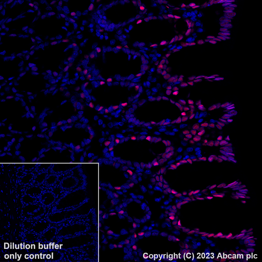 Immunohistochemistry (Formalin/PFA-fixed paraffin-embedded sections) - Alexa Fluor® 647 Anti-KLF4 antibody [EPR20753-25] (AB309501), expandable thumbnail