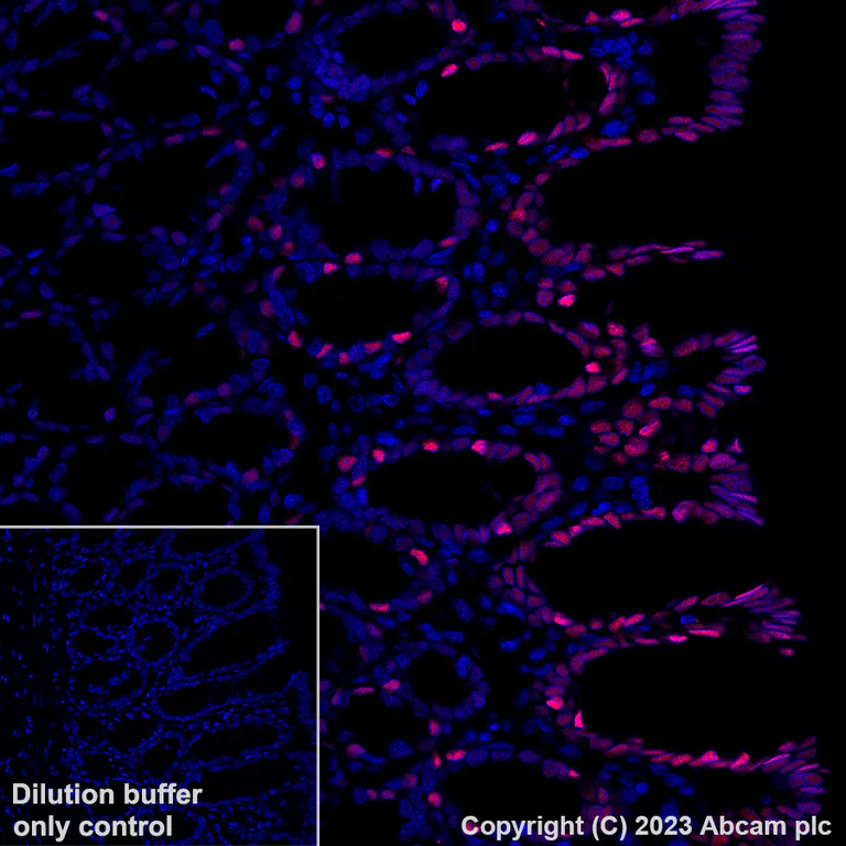 Immunohistochemistry (Formalin/PFA-fixed paraffin-embedded sections) - Alexa Fluor® 647 Anti-KLF4 antibody [EPR20753-25] (AB309501)