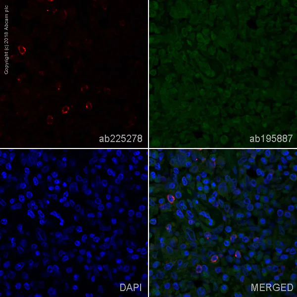 Immunohistochemistry (Formalin/PFA-fixed paraffin-embedded sections) - Alexa Fluor® 647 Anti-LAG-3 antibody [EPR4392(2)] (AB225278)