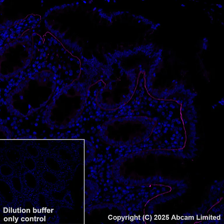 Immunohistochemistry (Formalin/PFA-fixed paraffin-embedded sections) - Alexa Fluor® 647 Anti-LAMA3 antibody [EPR28286-78] (AB325782)