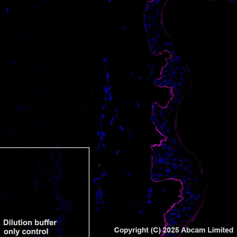 Immunohistochemistry (Formalin/PFA-fixed paraffin-embedded sections) - Alexa Fluor® 647 Anti-LAMA3 antibody [EPR28286-78] (AB325782)
