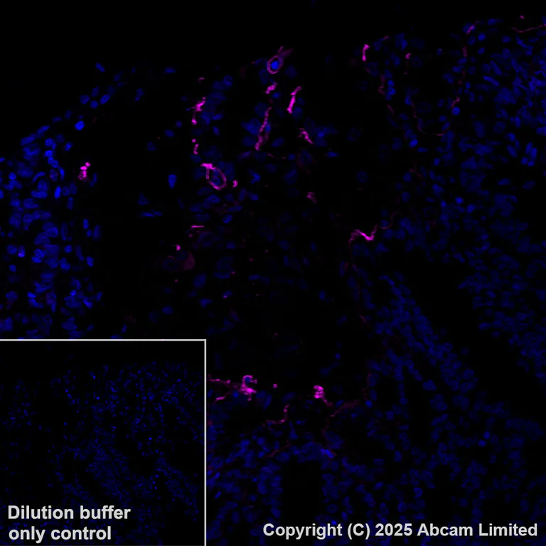 Immunohistochemistry (Formalin/PFA-fixed paraffin-embedded sections) - Alexa Fluor® 647 Anti-LAMA3 antibody [EPR28286-78] (AB325782)