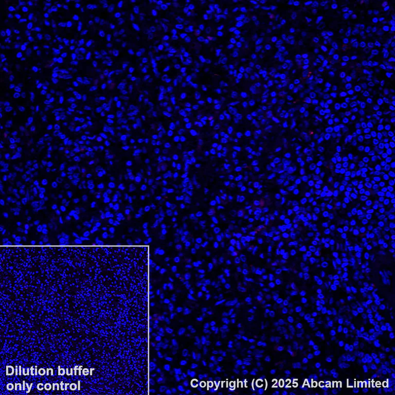 Immunohistochemistry (Formalin/PFA-fixed paraffin-embedded sections) - Alexa Fluor® 647 Anti-LAMA3 antibody [EPR28286-78] (AB325782)