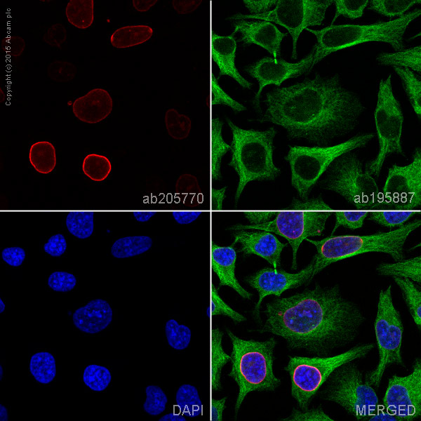 Immunocytochemistry/ Immunofluorescence - Alexa Fluor® 647 Anti-Lamin A + Lamin C antibody [EP4520-16] (AB205770)