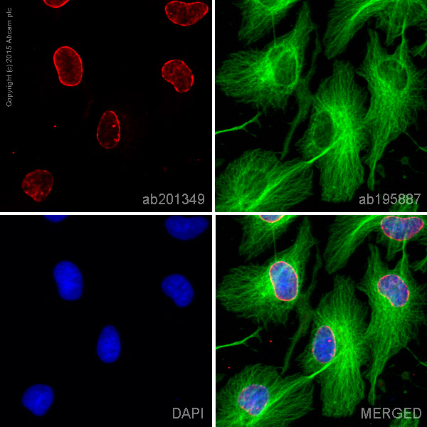 Immunocytochemistry/ Immunofluorescence - Alexa Fluor® 647 Anti-Lamin B Receptor/LBR antibody [E398L] (AB201349), expandable thumbnail