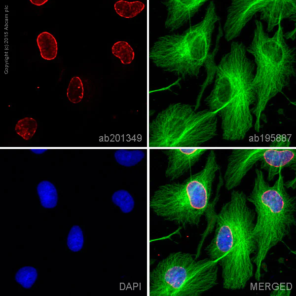 Immunocytochemistry/ Immunofluorescence - Alexa Fluor® 647 Anti-Lamin B Receptor/LBR antibody [E398L] (AB201349)