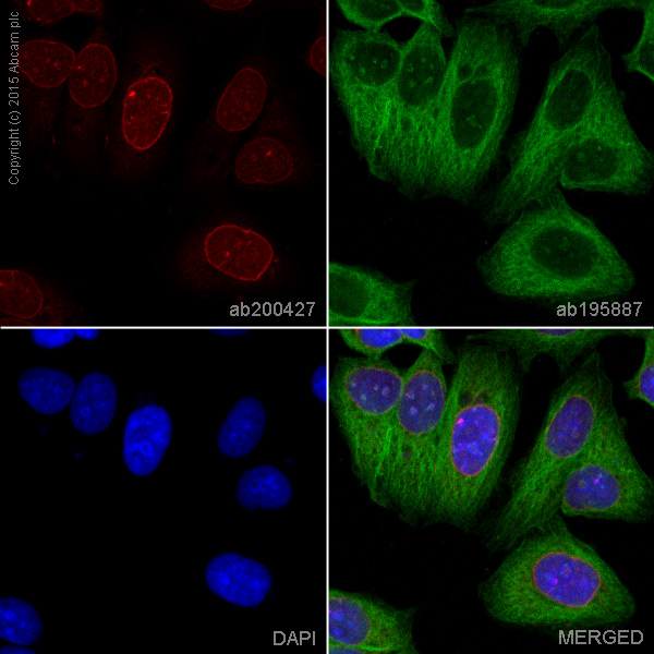 Immunocytochemistry/ Immunofluorescence - Alexa Fluor® 647 Anti-Lamin B2 antibody [EPR9701(B)] (AB200427), expandable thumbnail