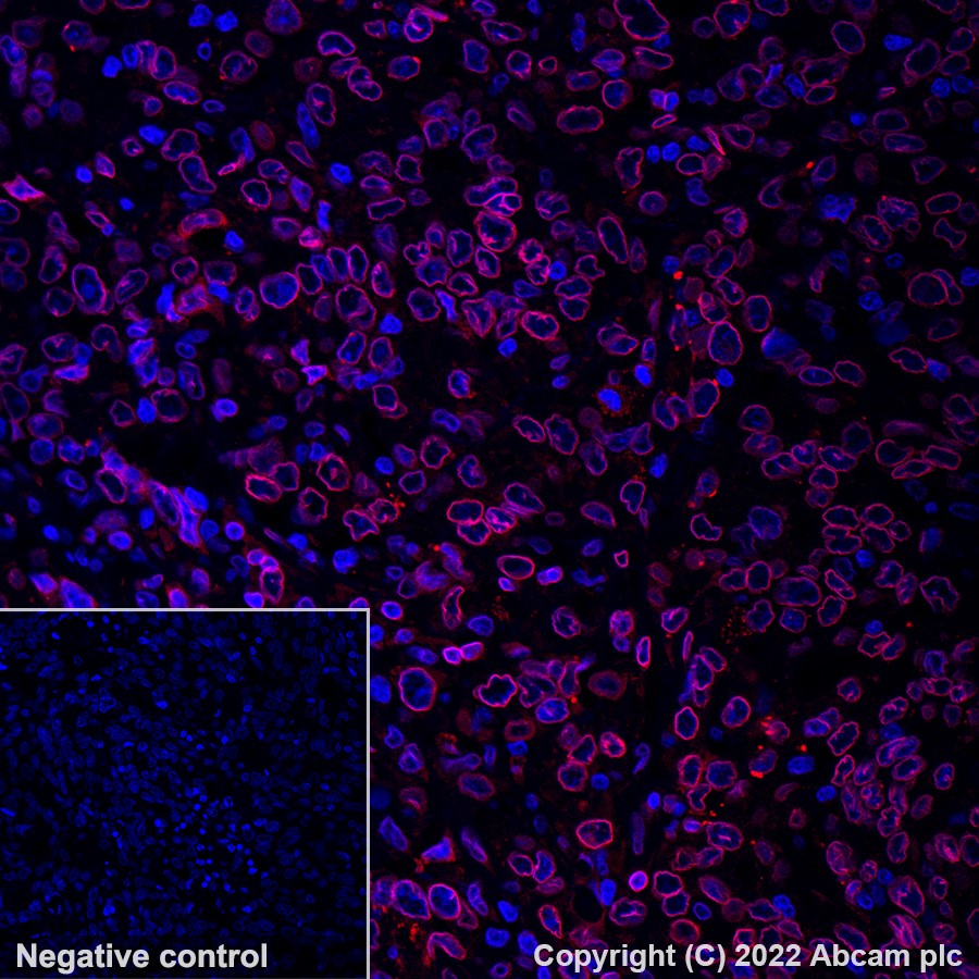 Immunohistochemistry (Formalin/PFA-fixed paraffin-embedded sections) - Alexa Fluor® 647 Anti-Lamin B2 antibody [EPR9701(B)] (AB200427), expandable thumbnail