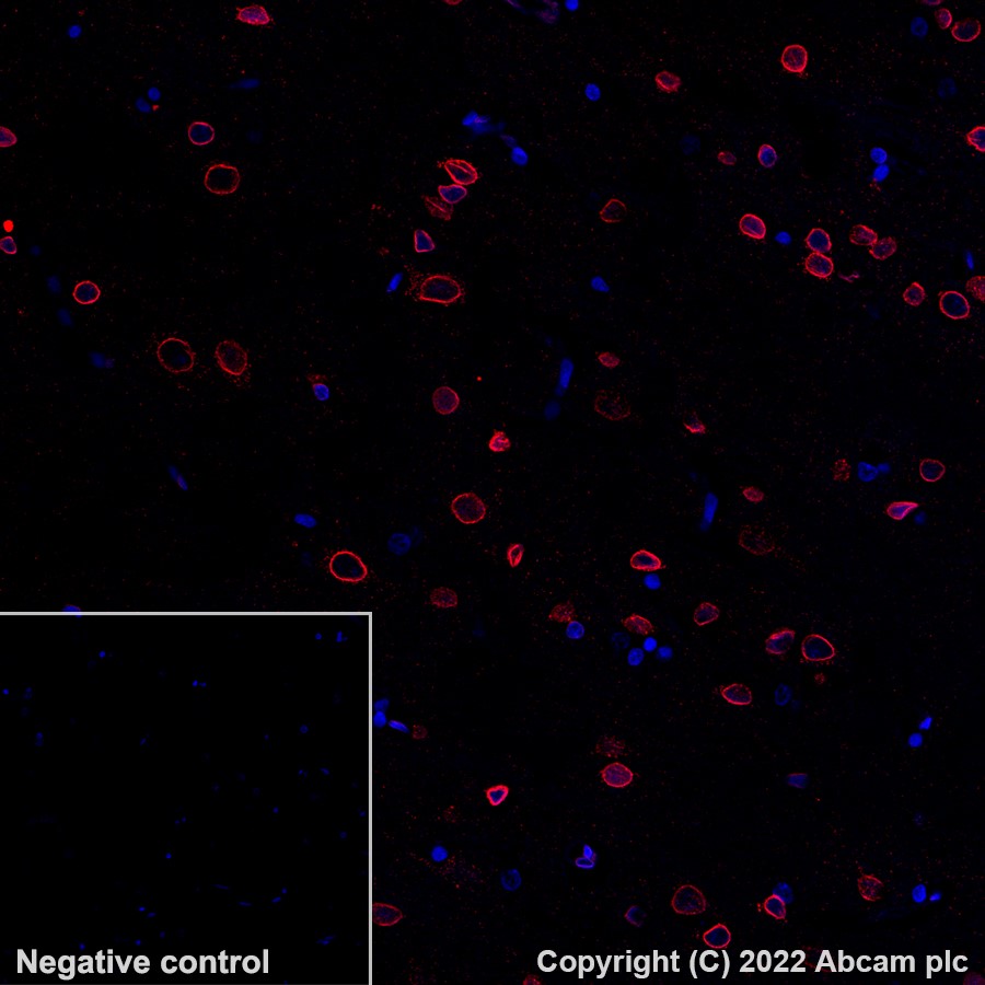 Immunohistochemistry (Formalin/PFA-fixed paraffin-embedded sections) - Alexa Fluor® 647 Anti-Lamin B2 antibody [EPR9701(B)] (AB200427), expandable thumbnail