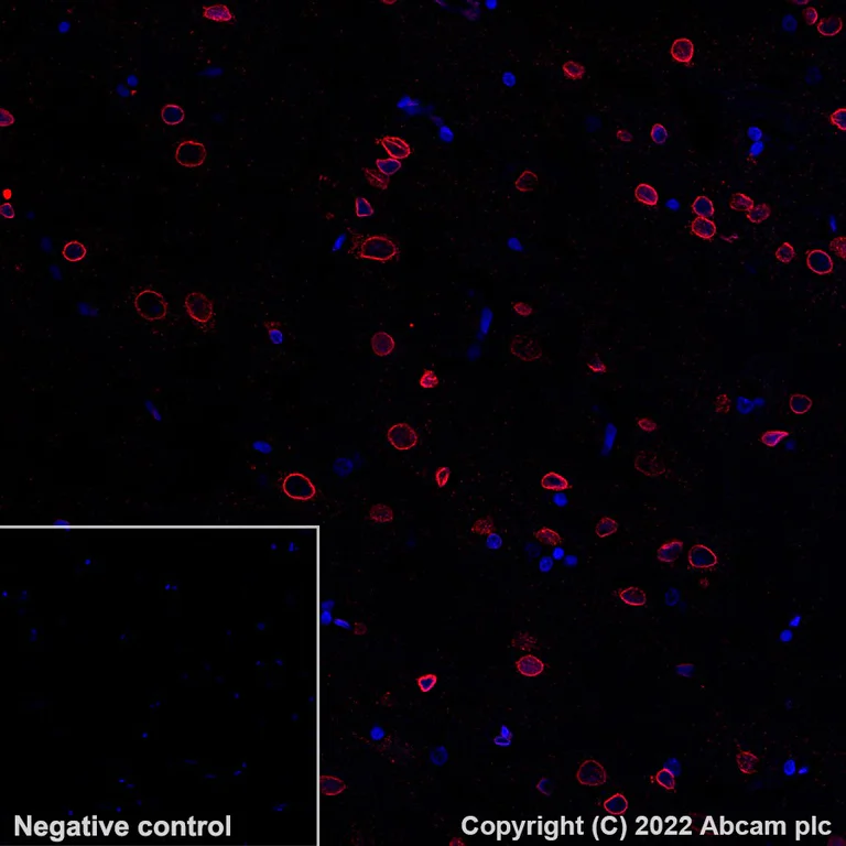 Immunohistochemistry (Formalin/PFA-fixed paraffin-embedded sections) - Alexa Fluor® 647 Anti-Lamin B2 antibody [EPR9701(B)] (AB200427)