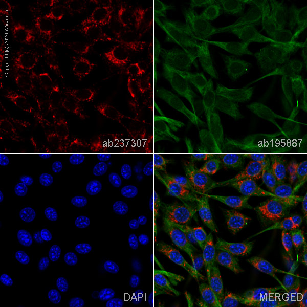 Immunocytochemistry/ Immunofluorescence - Alexa Fluor® 647 Anti-LAMP1 antibody [EPR21026] (AB237307), expandable thumbnail
