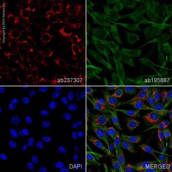 Immunocytochemistry/ Immunofluorescence - Alexa Fluor® 647 Anti-LAMP1 antibody [EPR21026] - Lysosome Marker (AB237307)