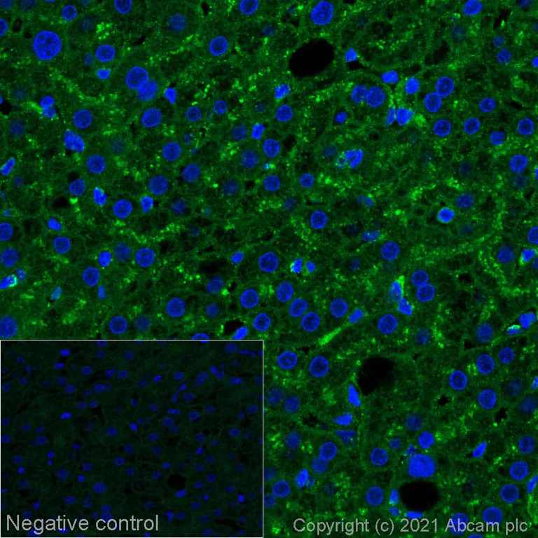 Immunohistochemistry (Formalin/PFA-fixed paraffin-embedded sections) - Alexa Fluor® 647 Anti-LAMP1 antibody [EPR24395-31] - Lysosome Marker (AB281328)