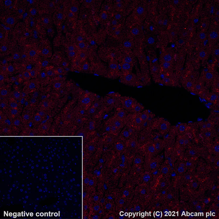 Immunohistochemistry (Formalin/PFA-fixed paraffin-embedded sections) - Alexa Fluor® 647 Anti-LAMP2A antibody [EPR4207(2)] - Lysosome Marker (AB284133)