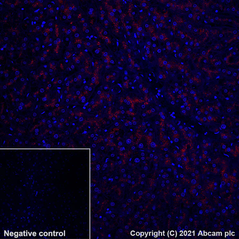 Immunohistochemistry (Formalin/PFA-fixed paraffin-embedded sections) - Alexa Fluor® 647 Anti-LAMP2A antibody [EPR4207(2)] - Lysosome Marker (AB284133)