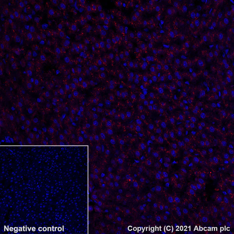 Immunohistochemistry (Formalin/PFA-fixed paraffin-embedded sections) - Alexa Fluor® 647 Anti-LAMP2A antibody [EPR4207(2)] - Lysosome Marker (AB284133)