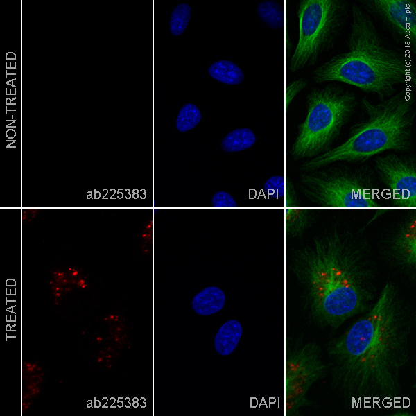 Immunocytochemistry/ Immunofluorescence - Alexa Fluor® 647 Anti-LC3B antibody [EPR18709] - Autophagosome Marker (AB225383), expandable thumbnail