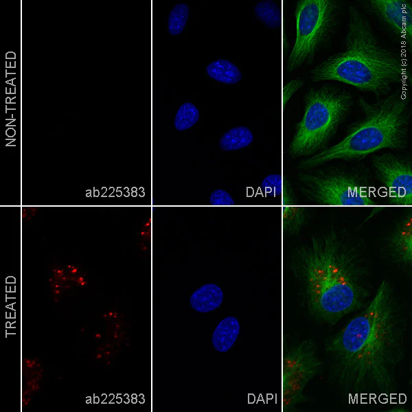 Immunocytochemistry/ Immunofluorescence - Alexa Fluor® 647 Anti-LC3B antibody [EPR18709] - Autophagosome Marker (AB225383)
