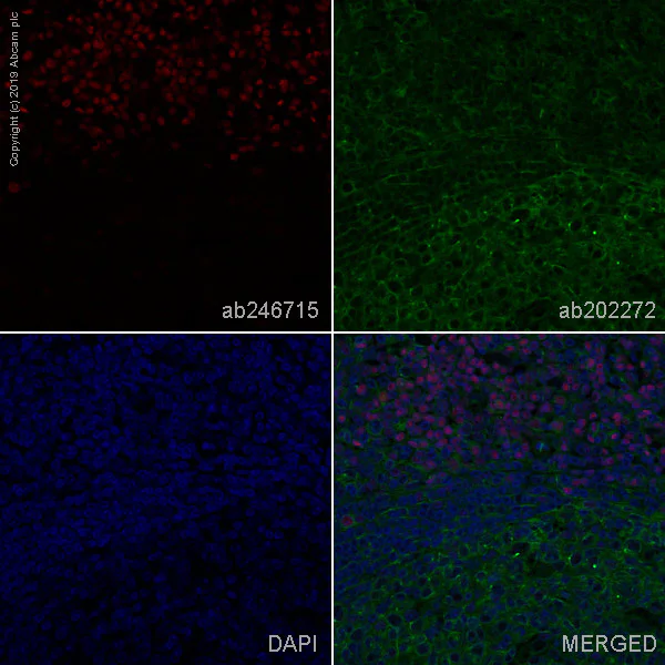 Immunohistochemistry (Formalin/PFA-fixed paraffin-embedded sections) - Alexa Fluor® 647 Anti-LEF1 antibody [EPR2029Y] (AB246715)