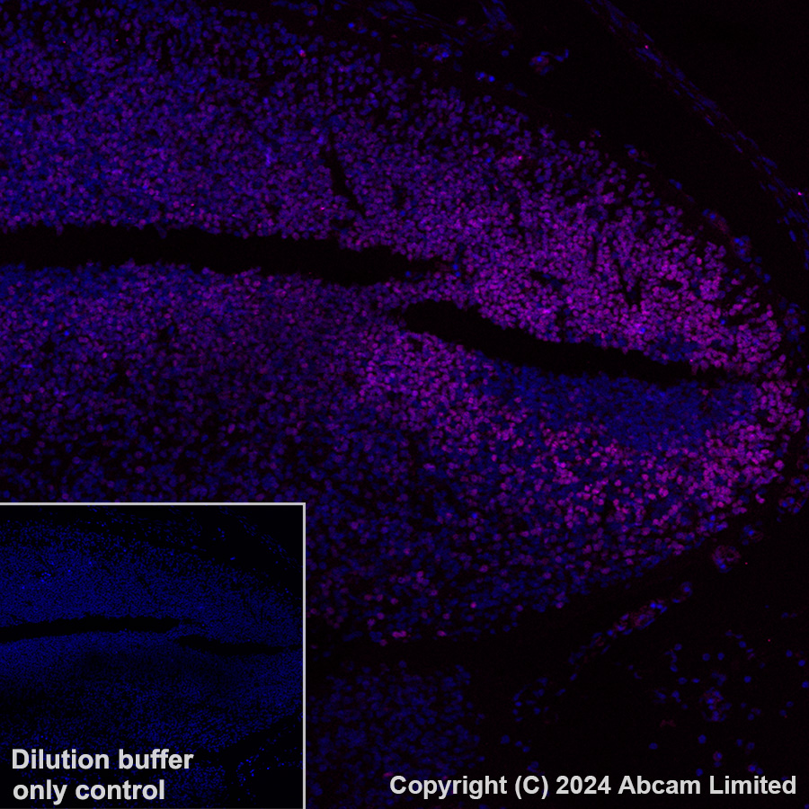 Immunohistochemistry (Formalin/PFA-fixed paraffin-embedded sections) - Alexa Fluor® 647 Anti-Lhx2/LH2 antibody [EPR20449] (AB322021), expandable thumbnail