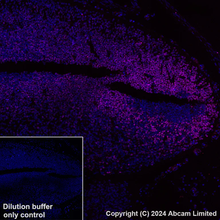 Immunohistochemistry (Formalin/PFA-fixed paraffin-embedded sections) - Alexa Fluor® 647 Anti-Lhx2/LH2 antibody [EPR20449] (AB322021)