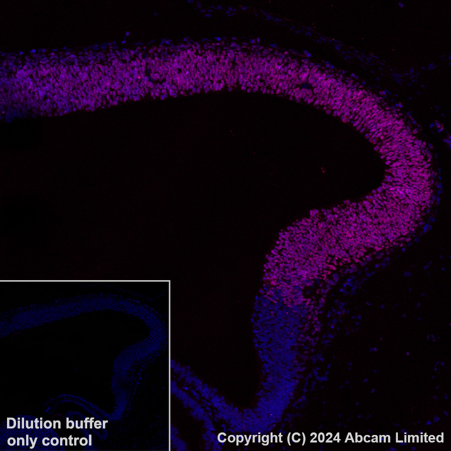 Immunohistochemistry (Formalin/PFA-fixed paraffin-embedded sections) - Alexa Fluor® 647 Anti-Lhx2/LH2 antibody [EPR20449] (AB322021), expandable thumbnail
