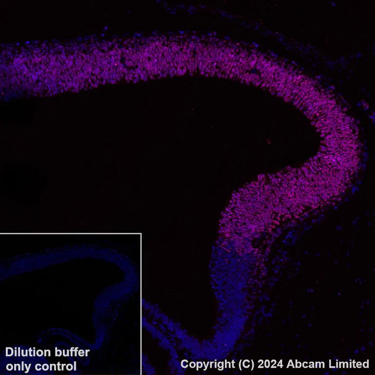Immunohistochemistry (Formalin/PFA-fixed paraffin-embedded sections) - Alexa Fluor® 647 Anti-Lhx2/LH2 antibody [EPR20449] (AB322021)