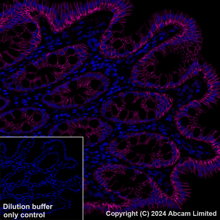 Immunohistochemistry (Formalin/PFA-fixed paraffin-embedded sections) - Alexa Fluor® 647 Anti-LI Cadherin antibody [EPR3996] (AB324000), expandable thumbnail