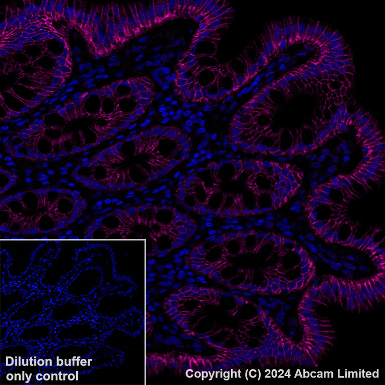 Immunohistochemistry (Formalin/PFA-fixed paraffin-embedded sections) - Alexa Fluor® 647 Anti-LI Cadherin antibody [EPR3996] (AB324000)