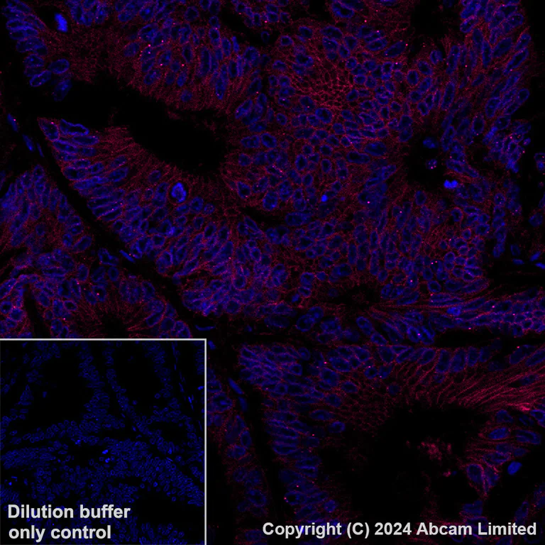 Immunohistochemistry (Formalin/PFA-fixed paraffin-embedded sections) - Alexa Fluor® 647 Anti-LI Cadherin antibody [EPR3996] (AB324000)
