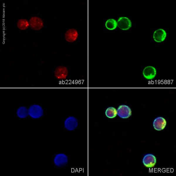 Immunocytochemistry/ Immunofluorescence - Alexa Fluor® 647 Anti-LIMK2 antibody [EP969Y] (AB224967)