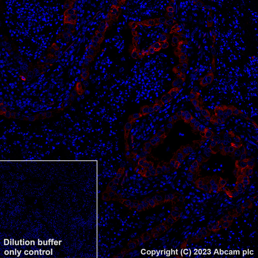 Immunohistochemistry (Formalin/PFA-fixed paraffin-embedded sections) - Alexa Fluor® 647 Anti-LINE-1 ORF1p antibody [EPR22227-6] (AB314927), expandable thumbnail