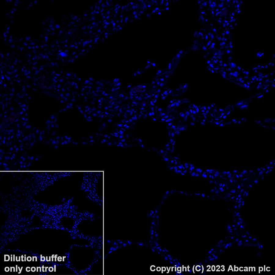 Immunohistochemistry (Formalin/PFA-fixed paraffin-embedded sections) - Alexa Fluor® 647 Anti-LINE-1 ORF1p antibody [EPR22227-6] (AB314927), expandable thumbnail