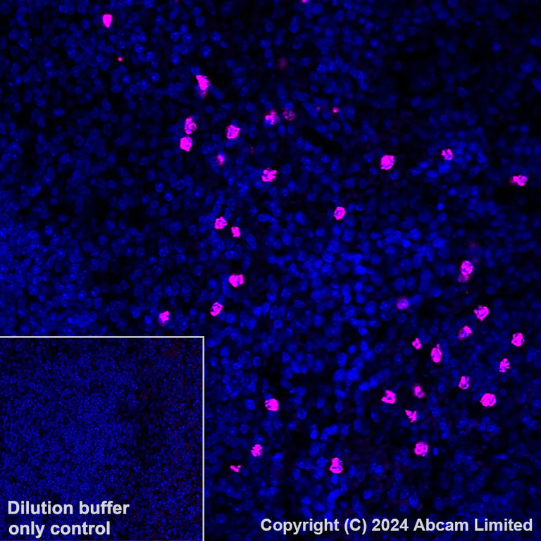 Immunohistochemistry (Formalin/PFA-fixed paraffin-embedded sections) - Alexa Fluor® 647 Anti-Lipocalin-2 / NGAL antibody [EPR21092] (AB321940)