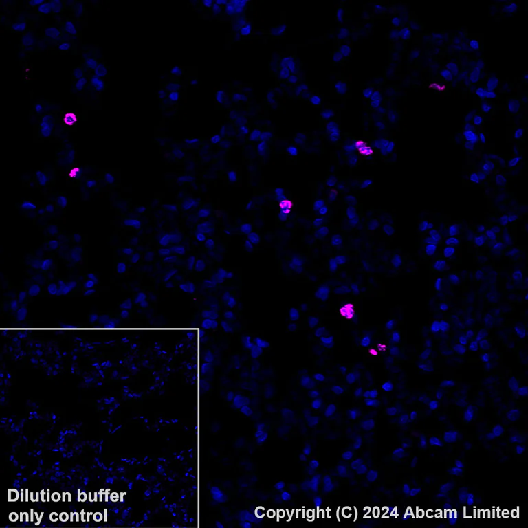 Immunohistochemistry (Formalin/PFA-fixed paraffin-embedded sections) - Alexa Fluor® 647 Anti-Lipocalin-2 / NGAL antibody [EPR21092] (AB321940)
