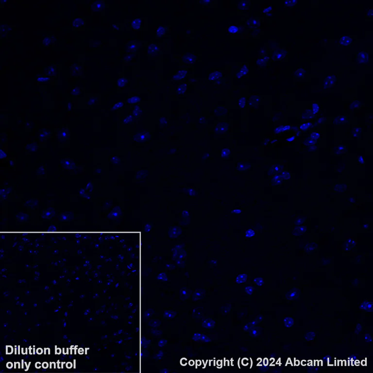 Immunohistochemistry (Formalin/PFA-fixed paraffin-embedded sections) - Alexa Fluor® 647 Anti-Lipocalin-2 / NGAL antibody [EPR21092] (AB321940)