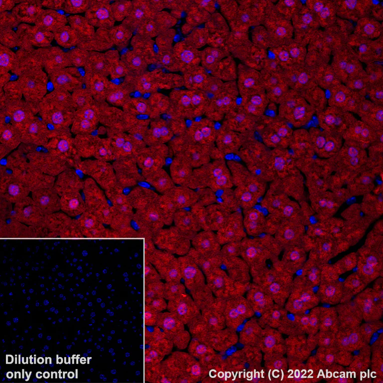 Immunohistochemistry (Formalin/PFA-fixed paraffin-embedded sections) - Alexa Fluor® 647 Anti-Liver Arginase antibody [EPR22033-369] (AB307468)