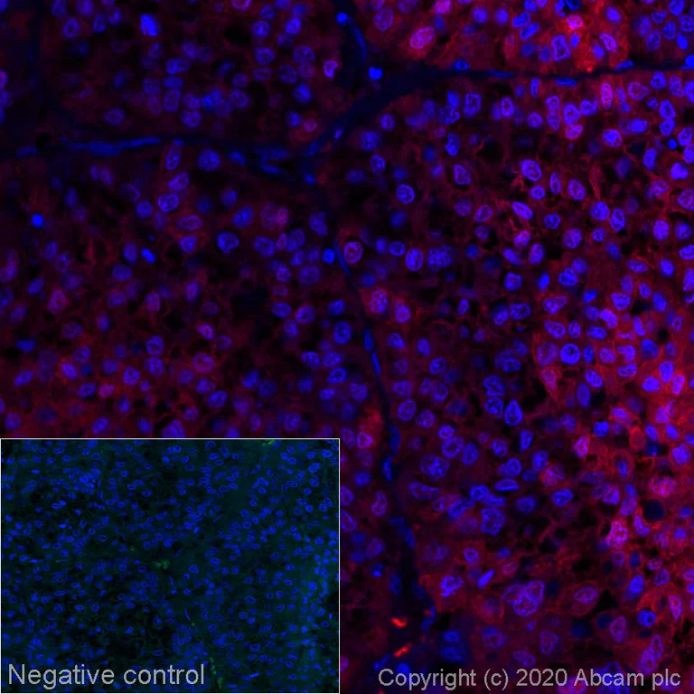 Immunohistochemistry (Formalin/PFA-fixed paraffin-embedded sections) - Alexa Fluor® 647 Anti-Liver Arginase antibody [EPR6672(B)] (AB277922)