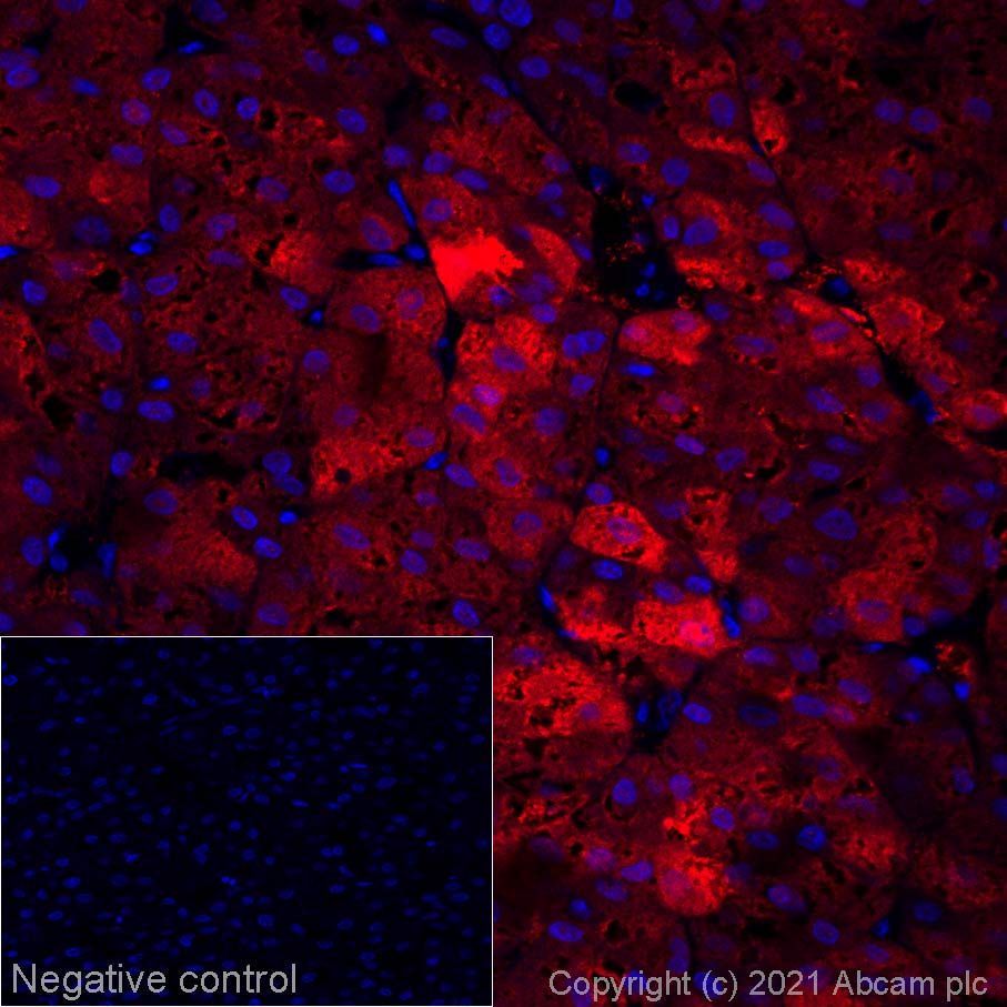 Immunohistochemistry (Formalin/PFA-fixed paraffin-embedded sections) - Alexa Fluor® 647 Anti-Liver Arginase antibody [SP156] (AB270146)