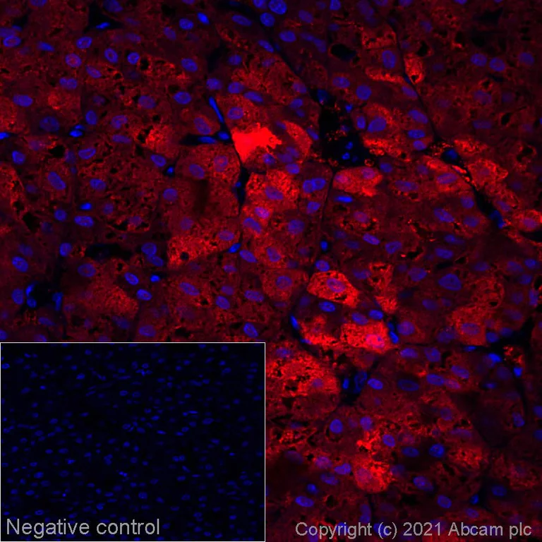 Immunohistochemistry (Formalin/PFA-fixed paraffin-embedded sections) - Alexa Fluor® 647 Anti-Liver Arginase antibody [SP156] (AB270146)