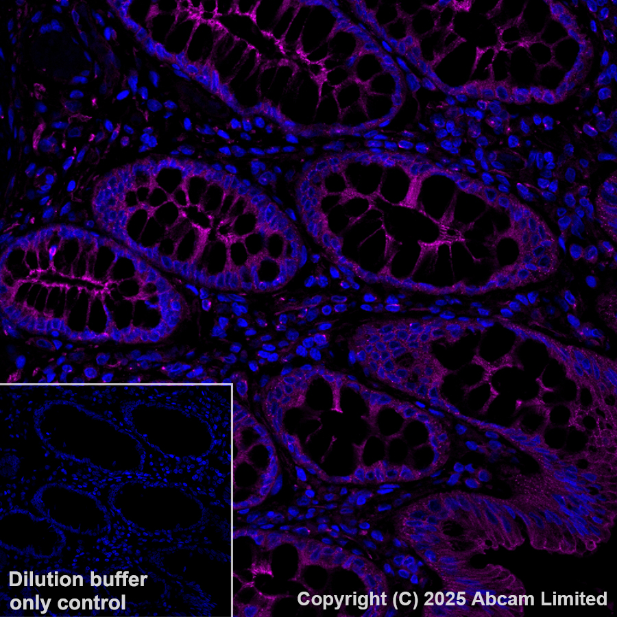 Anti-LOX Alexa Fluor® 647 antibody [EPR4025] (ab197061) IgG | Abcam