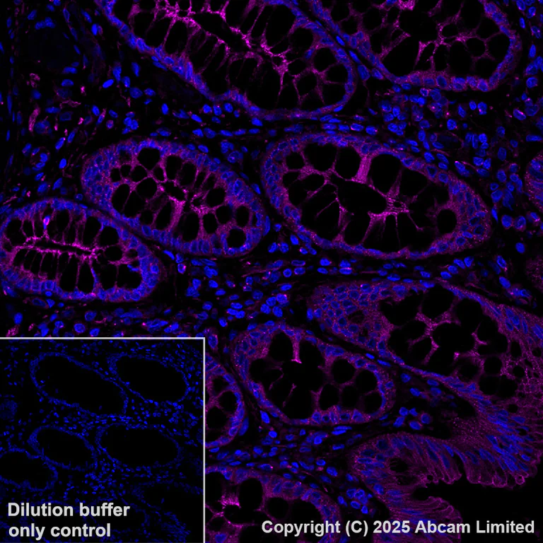 Immunohistochemistry (Formalin/PFA-fixed paraffin-embedded sections) - Alexa Fluor® 647 Anti-LOX antibody [EPR4025] (AB197061)