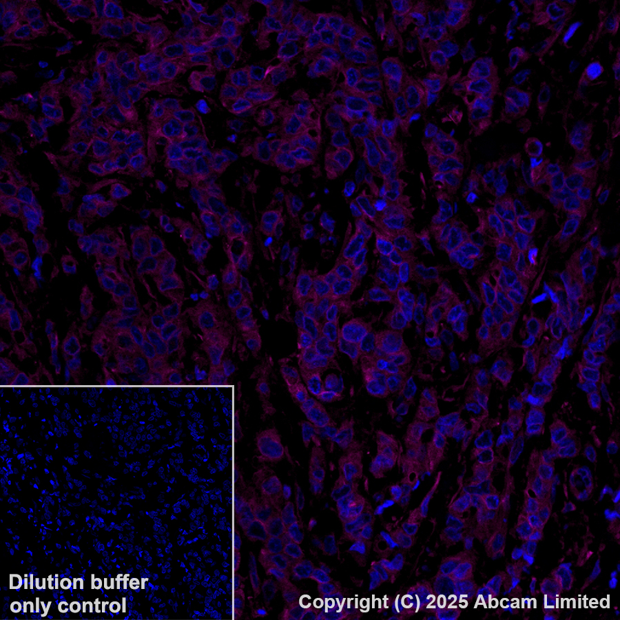 Immunohistochemistry (Formalin/PFA-fixed paraffin-embedded sections) - Alexa Fluor® 647 Anti-LOX antibody [EPR4025] (AB197061)