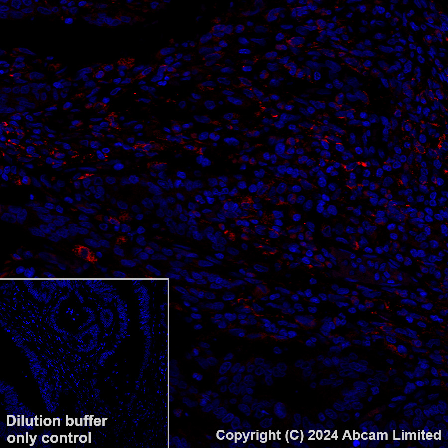 Immunohistochemistry (Formalin/PFA-fixed paraffin-embedded sections) - Alexa Fluor® 647 Anti-LOXL2 antibody [EPR28298-7] (AB319021), expandable thumbnail