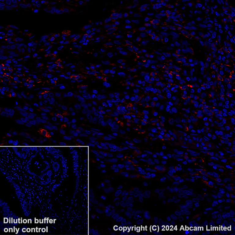 Immunohistochemistry (Formalin/PFA-fixed paraffin-embedded sections) - Alexa Fluor® 647 Anti-LOXL2 antibody [EPR28298-7] (AB319021)