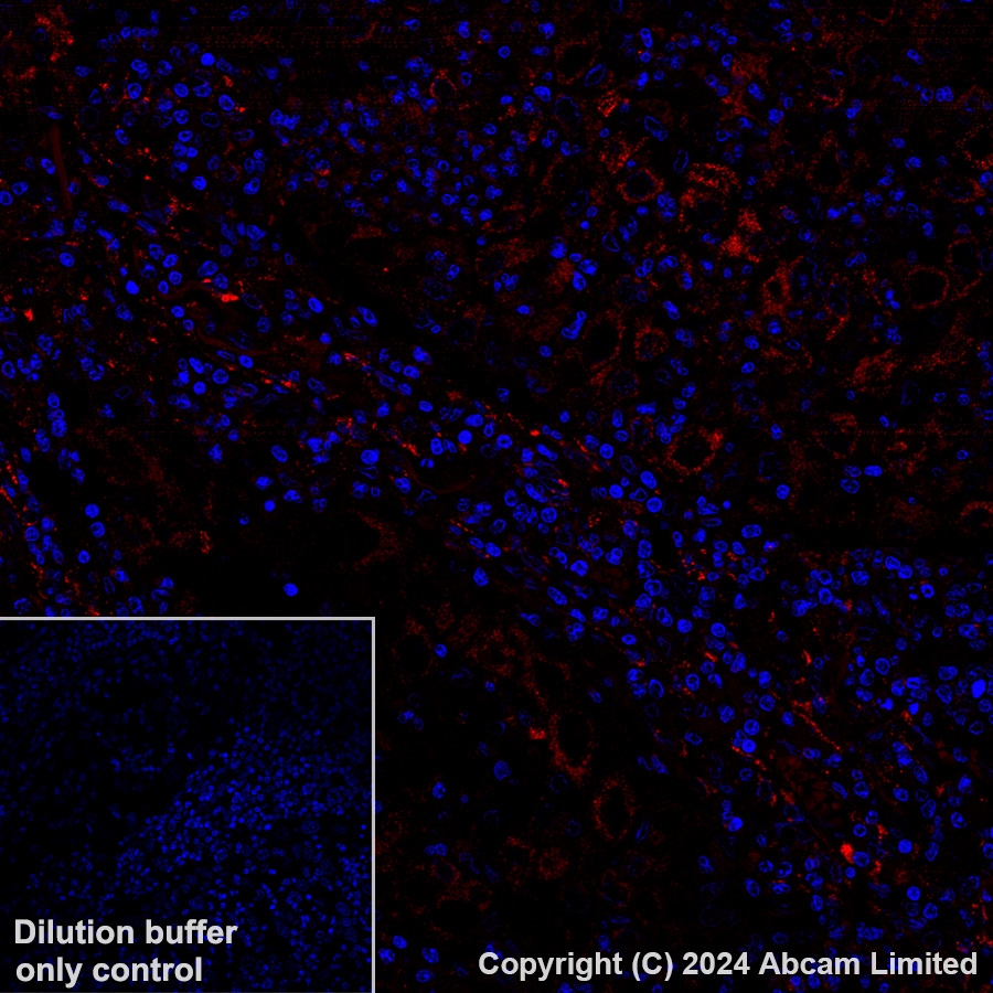 Immunohistochemistry (Formalin/PFA-fixed paraffin-embedded sections) - Alexa Fluor® 647 Anti-LOXL2 antibody [EPR28298-7] (AB319021), expandable thumbnail