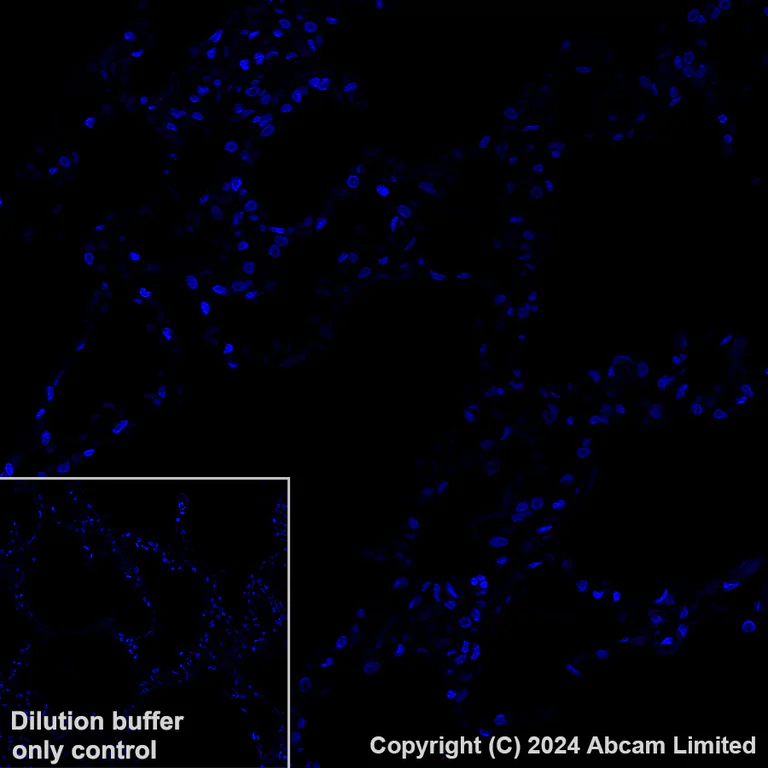 Immunohistochemistry (Formalin/PFA-fixed paraffin-embedded sections) - Alexa Fluor® 647 Anti-LOXL2 antibody [EPR28298-7] (AB319021)